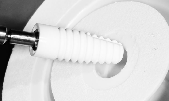L'implant Zircone l'avenir de l'implantologie